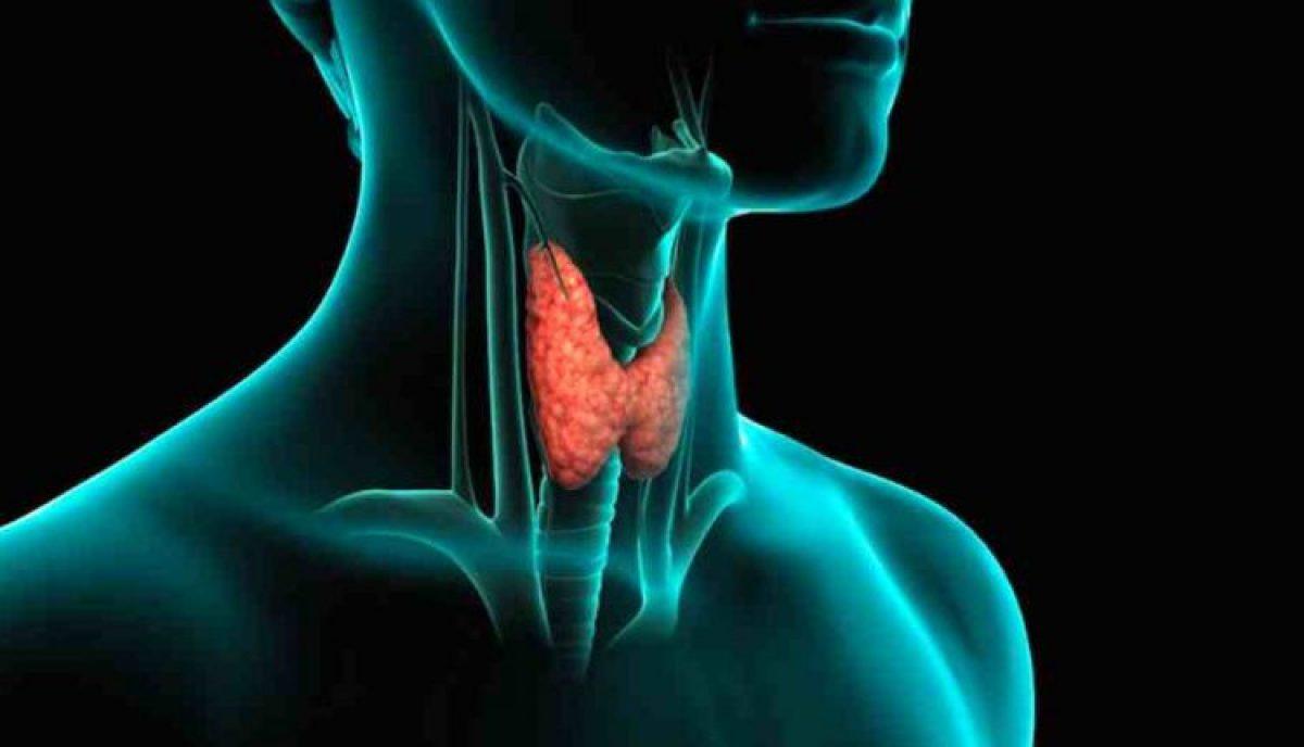 Glande thyroïde : Hyperthyroïdie ou hypothyroïdie?
